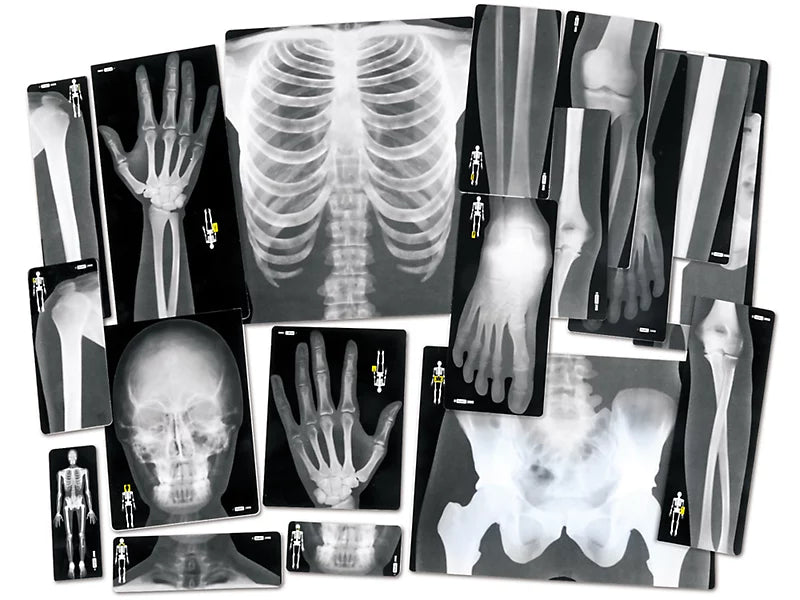 CS40. Set Radiografías Cuerpo Humano